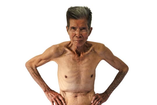 زيادة الوزن