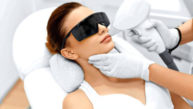 إزالة الشعر بالليزر